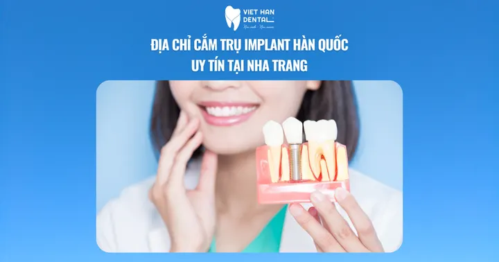 Địa chỉ cắm trụ implant Hàn Quốc uy tín tại Nha Trang