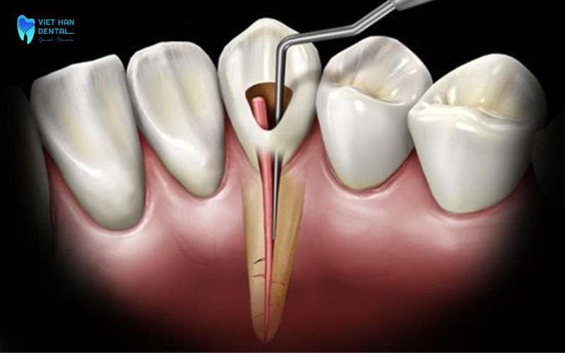 Xác định tình trạng tủy