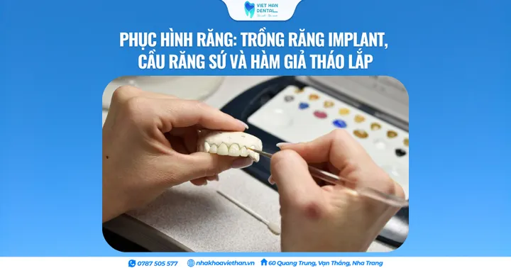 Phương pháp phục hình răng: trồng răng Implant, cầu răng sứ và hàm giả tháo lắp