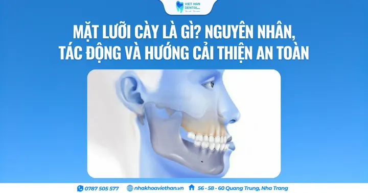Mặt lưỡi cày là gì? Nguyên nhân, tác động và hướng cải thiện an toàn