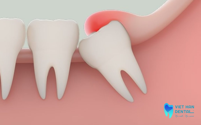 Đánh giá hướng mọc