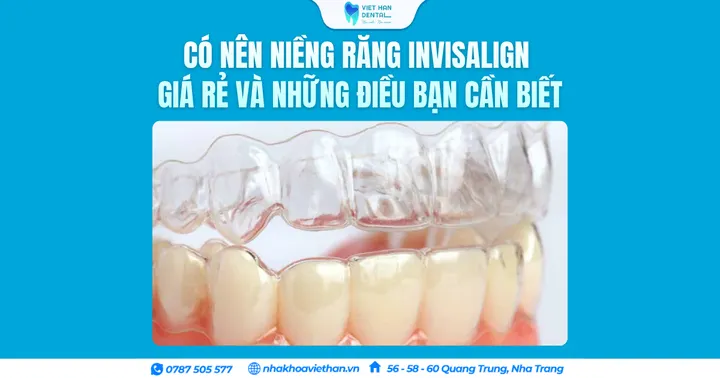 Có nên niềng răng Invisalign giá rẻ và những điều bạn cần biết