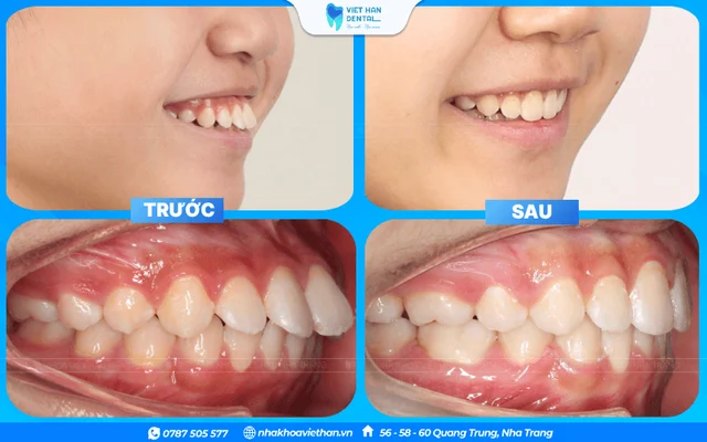 KhÁch HÀng BÁc NgÂn (1) của Bác sĩ Hoàng Thị Thảo Ngân