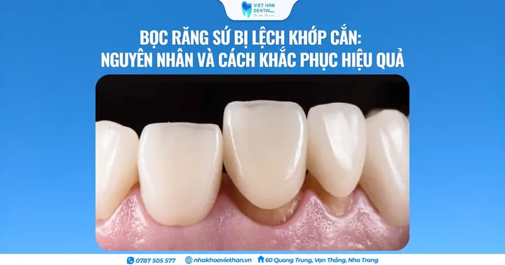 Bọc răng sứ bị lệch khớp cắn: Nguyên nhân và cách khắc phục hiệu quả