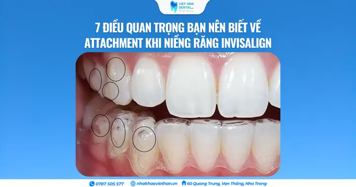 7 điều quan trọng bạn nên biết về Attachment khi niềng răng Invisalign