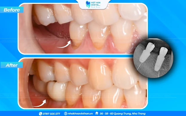 Hình ảnh khách hàng 5 của Bác sĩ Phạm Nhật Huy