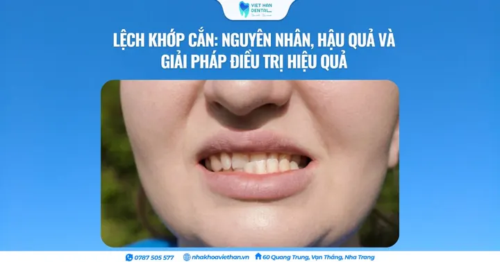 Lệch khớp cắn: Nguyên nhân, hậu quả và giải pháp điều trị hiệu quả