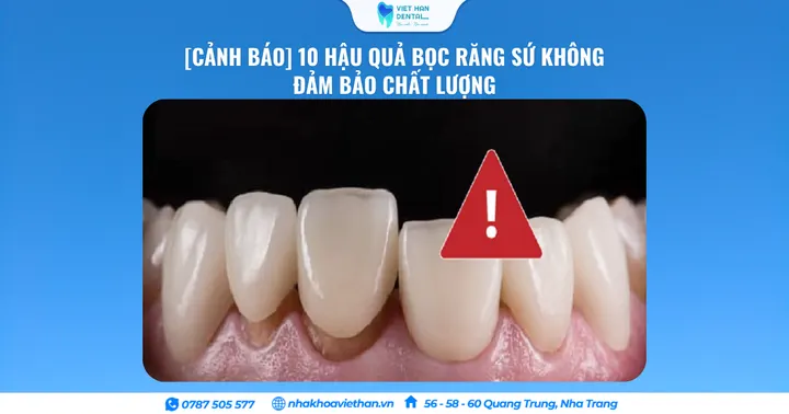 [Cảnh Báo] 10 Hậu Quả Khôn Lường Khi Bọc Răng Sứ Kém Chất Lượng