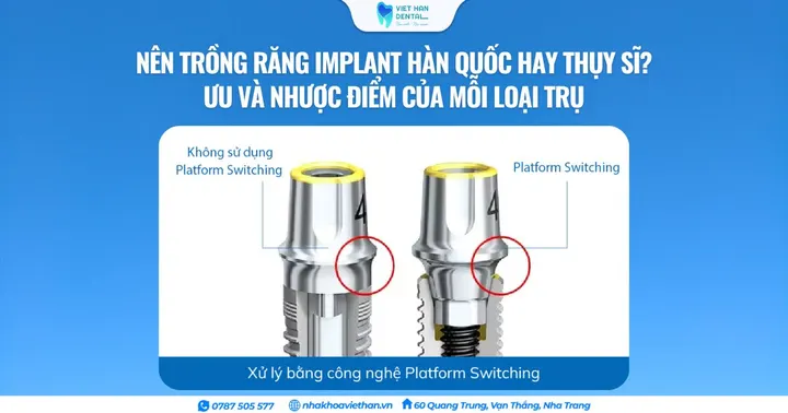 Nên trồng răng Implant Hàn Quốc hay Thụy Sĩ? Ưu và nhược điểm của mỗi loại trụ