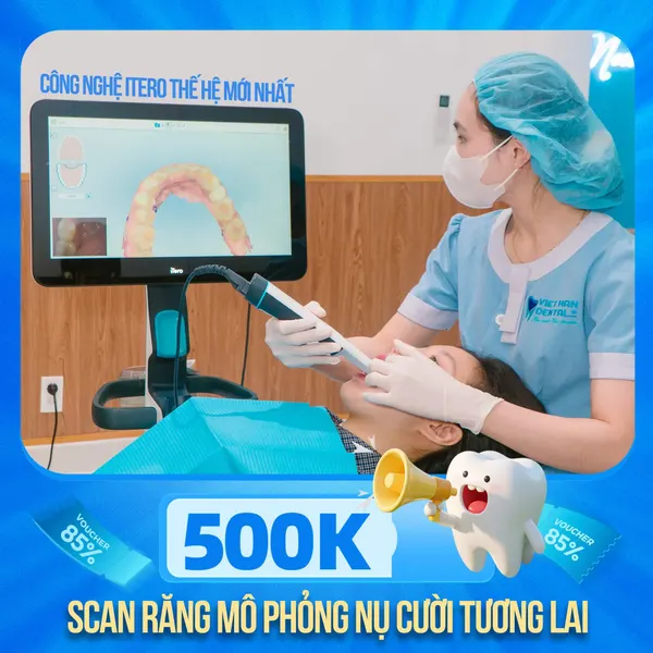 Scan Răng