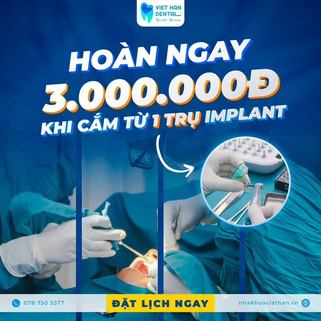 Hoàn ngay 3.000.000đ khi trồng từ 01 trụ Implant tại Nha khoa Việt Hàn