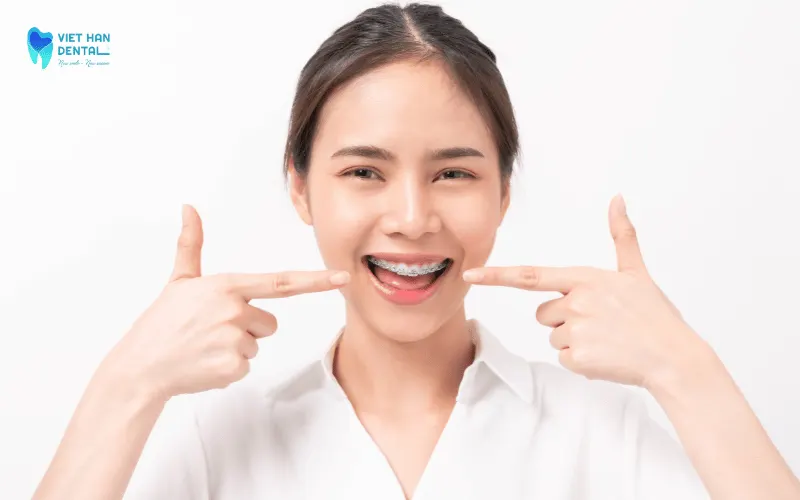 Mắc cài kim loại
