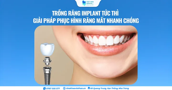 Trồng răng Implant tức thì – Giải pháp phục hình răng mất nhanh chóng