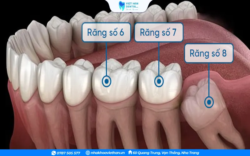Vị trí răng số 7