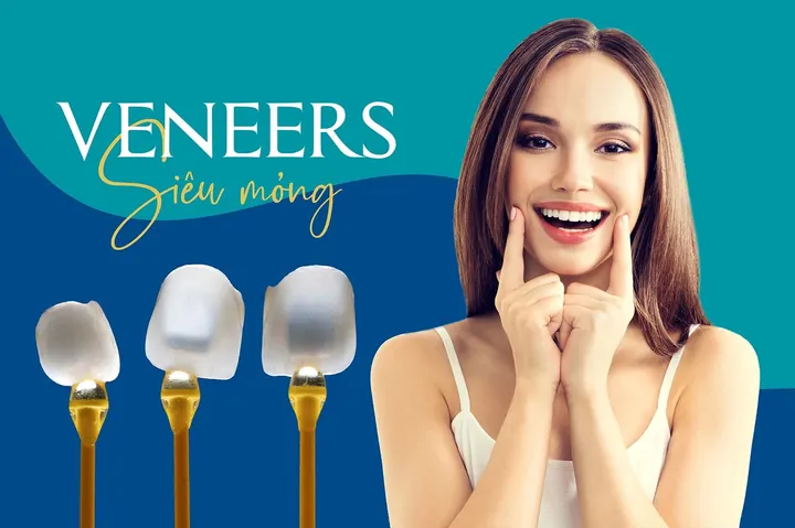 Bạn xứng đáng được có một nụ cười đẹp
