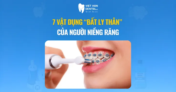 7 vật dụng “bất ly thân” của người niềng răng