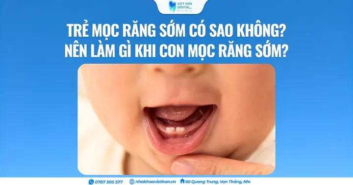 Trẻ mọc răng sớm có sao không? Nên làm gì khi con mọc răng sớm?