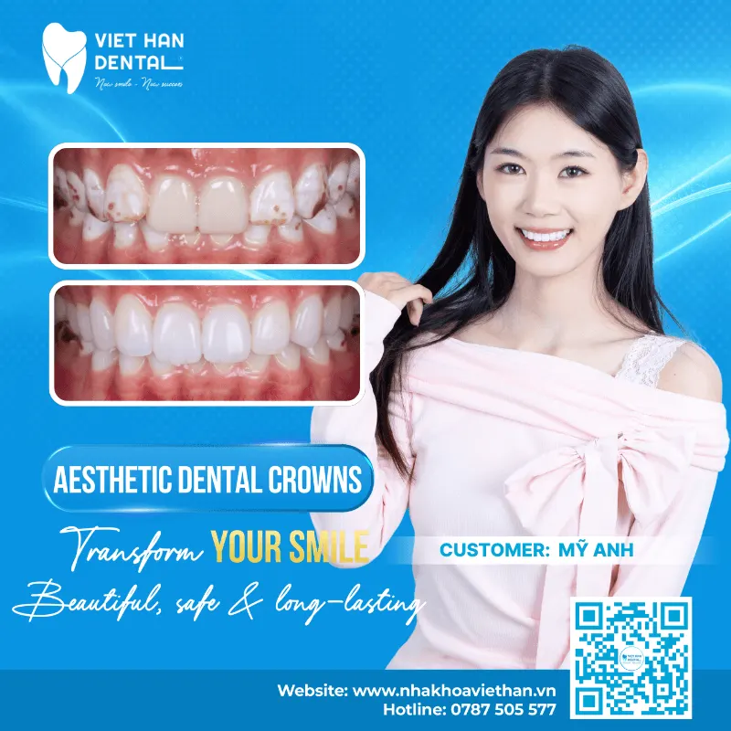 Mỹ Anh’s smile makeover