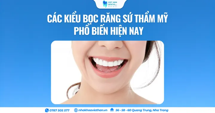 Các kiểu bọc răng sứ thẩm mỹ phổ biến hiện nay