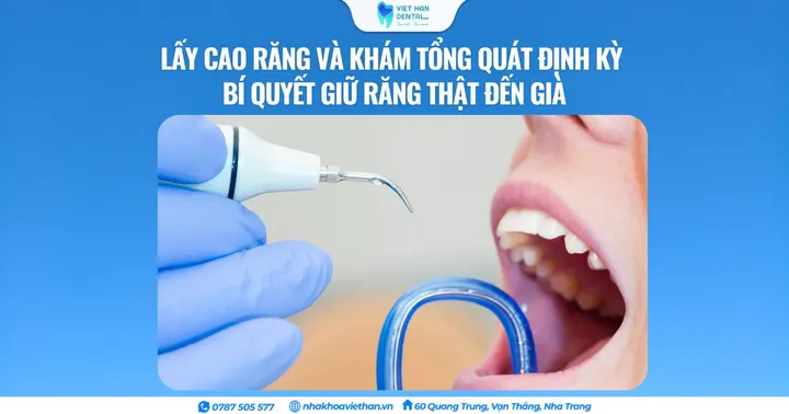 Lấy cao răng và khám tổng quát định kỳ – Bí quyết giữ răng thật đến già