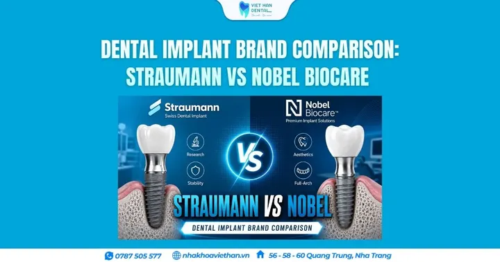 Dental Implant Brand Comparison: Straumann vs Nobel Biocare – Which One Should You Choose?