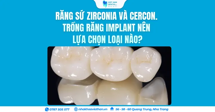 Răng sứ Zirconia và Cercon. Trồng răng Implant nên lựa chọn loại nào?