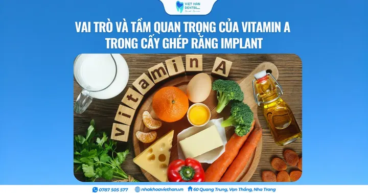 Vai trò và tầm quan trọng của Vitamin A trong cấy ghép răng Implant