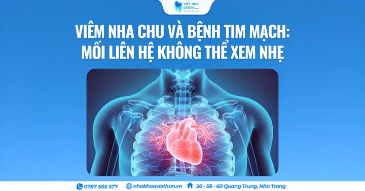 Viêm nha chu và bệnh tim mạch: Mối liên hệ không thể xem nhẹ