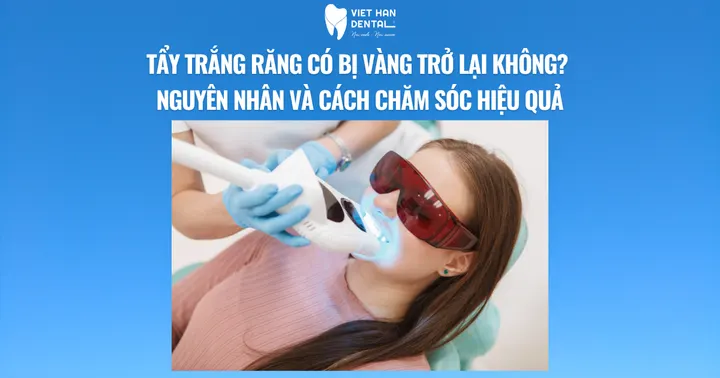 Tẩy trắng răng có bị vàng trở lại không? Nguyên nhân và cách chăm sóc hiệu quả