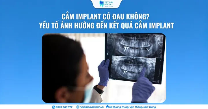 Cắm implant có đau không? Yếu tố ảnh hưởng đến kết quả cắm implant