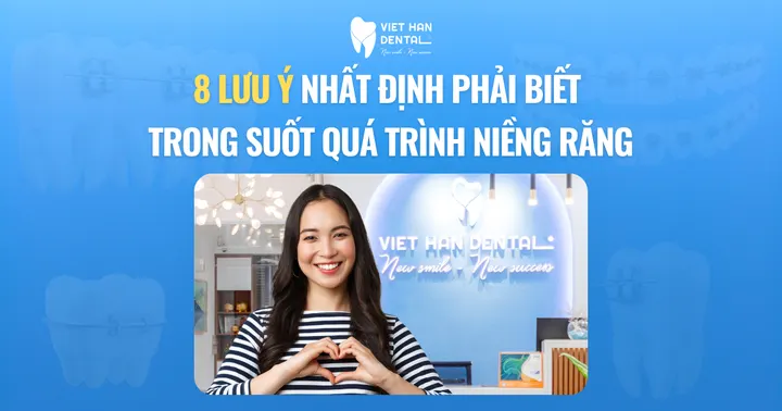 8 lưu ý nhất định phải biết trong suốt quá trình niềng răng
