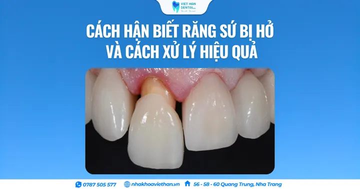 Cách nhận biết răng sứ bị hở và cách xử lý hiệu quả