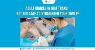 Adult Braces in Nha Trang: Is It Too Late to Straighten Your Smile?