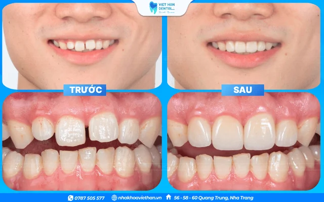 Hình ảnh khách hàng 3 của Bác sĩ Hoàng Thị Thảo Ngân