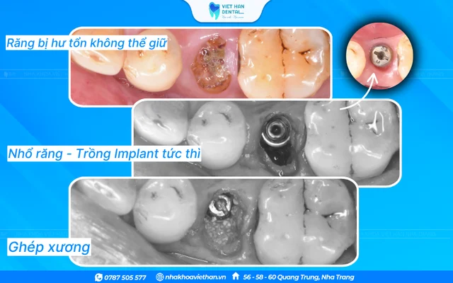 Hình ảnh khách hàng 6 của Bác sĩ Phạm Nhật Huy