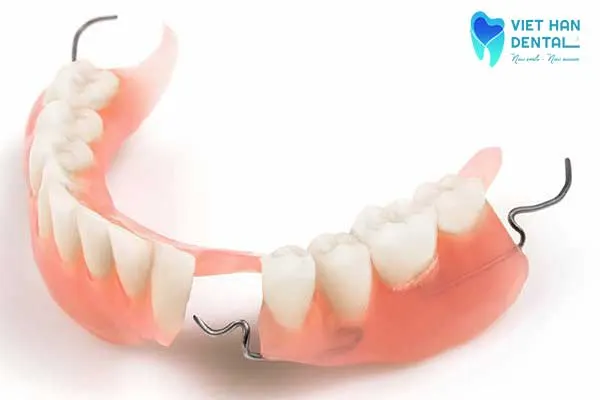 Hàm giả tháo lắp