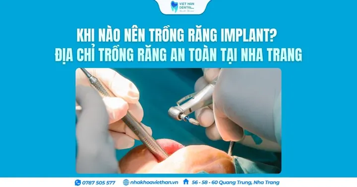 Khi nào nên trồng răng Implant? Địa chỉ trồng răng an toàn tại Nha Trang
