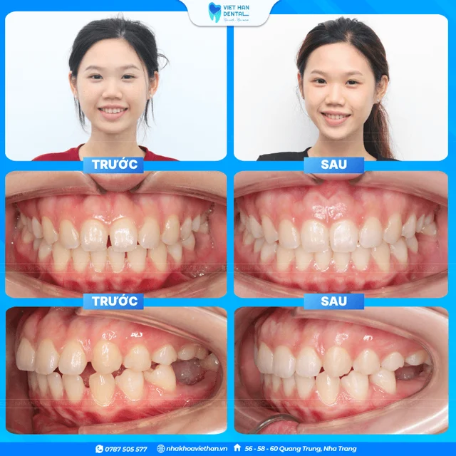 Hình ảnh khách hàng 1 của Bác sĩ Hồng Thạnh An