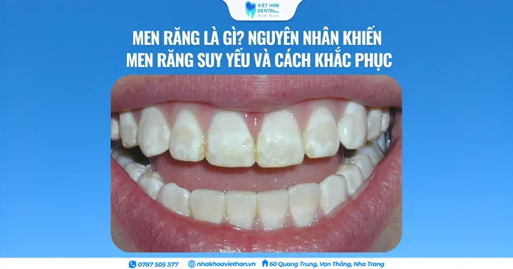 Men răng là gì? Nguyên nhân khiến men răng suy yếu và cách khắc phục