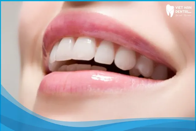 Bọc răng sứ thẩm mỹ là gì?