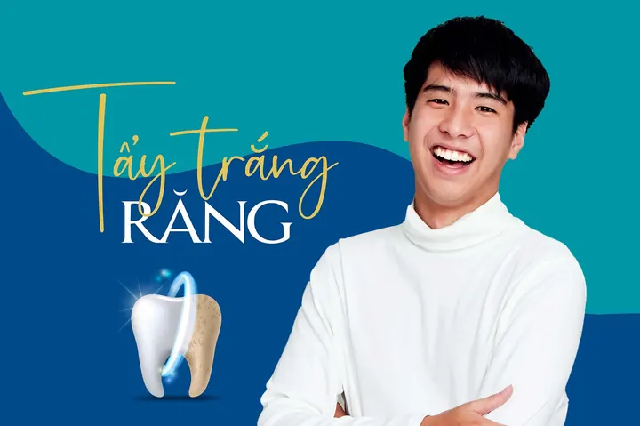 Tẩy trắng răng