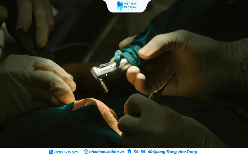 Nha khoa Việt Hàn cam kết sử dụng trụ Implant chính hãng