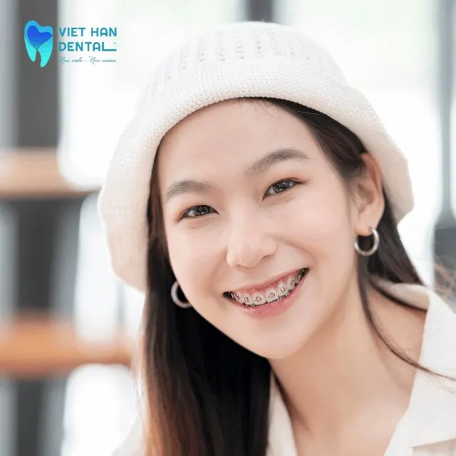 Lợi ích của niềng răng đúng cách?