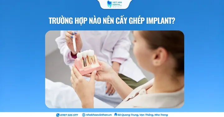 Trường hợp nào nên cấy ghép implant?