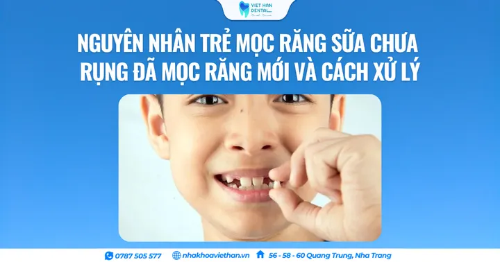 Nguyên nhân trẻ mọc răng sữa chưa rụng đã mọc răng mới và cách xử lý