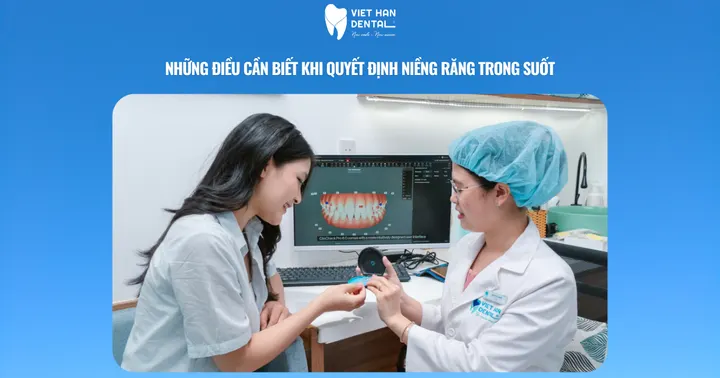 Những điều cần biết về niềng răng trong suốt