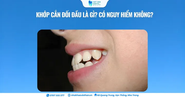 Khớp cắn đối đầu là gì? Có nguy hiểm không?
