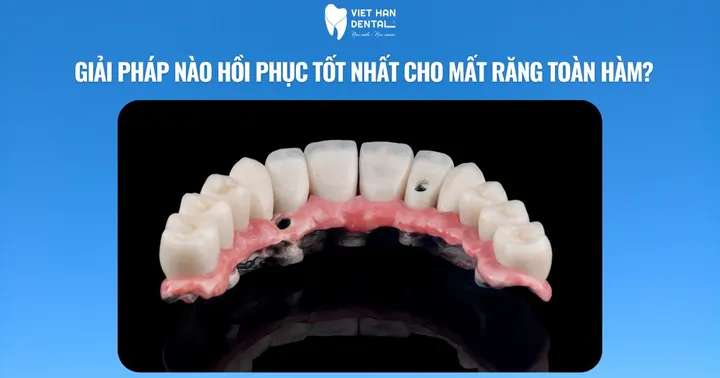 Giải pháp nào hồi phục tốt nhất cho mất răng toàn hàm?