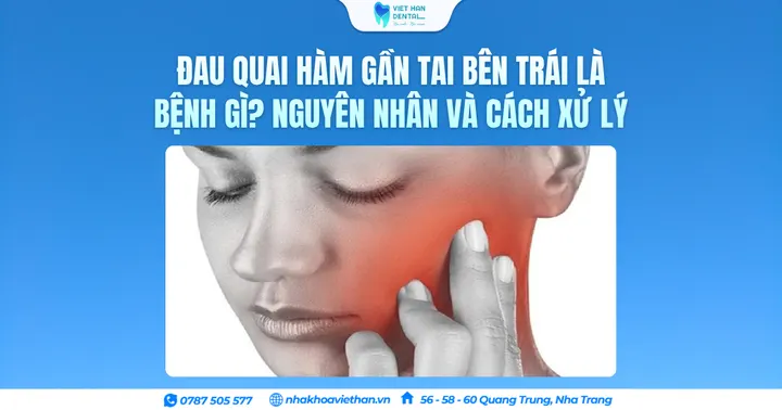 Đau quai hàm gần tai bên trái là bệnh gì? Nguyên nhân và cách xử lý