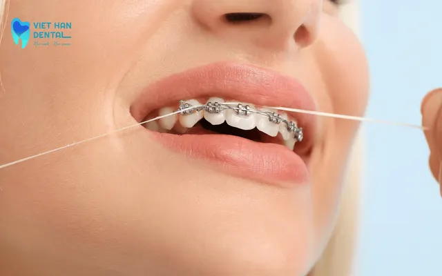 Sử dụng chỉ nha khoa